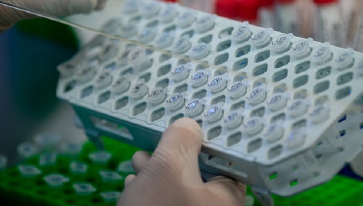 Українські науковці виготовили першу партію експрес-тестів