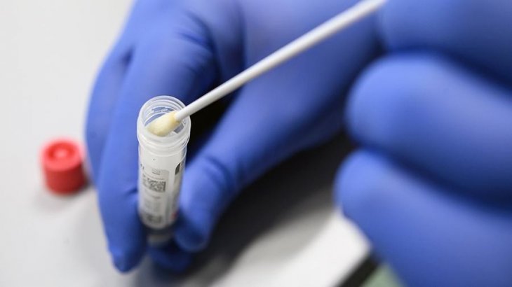 У світі вже понад 800 тисяч випадків заражень коронавірусом