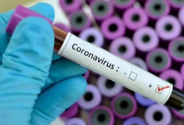 Станом на ранок 8 червня у Львові та на Львівщині 2162 випадки інфікування коронавірусом