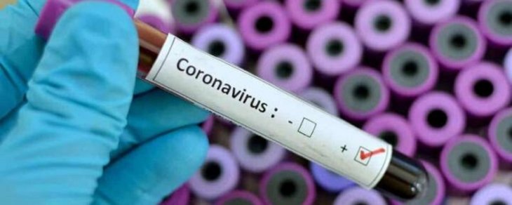 В Україні за добу виявили 5 804 нові випадки коронавірусу