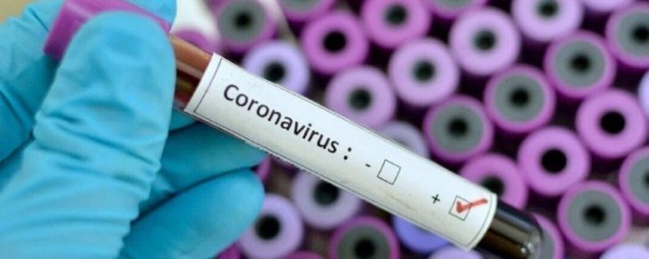 В Україні - 5 334 випадки коронавірусу за добу