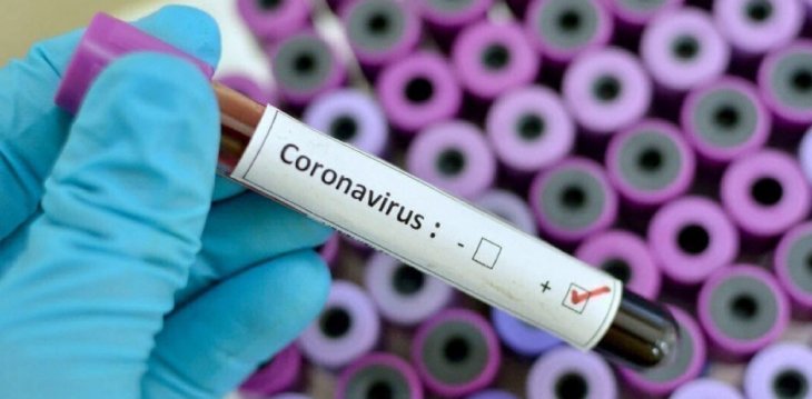 В Україні - 5 676 нових випадків коронавірусу