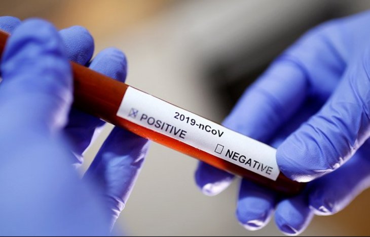 У стаціонарах Львівщини лікують 1 299 пацієнтів, хворих на коронавірус