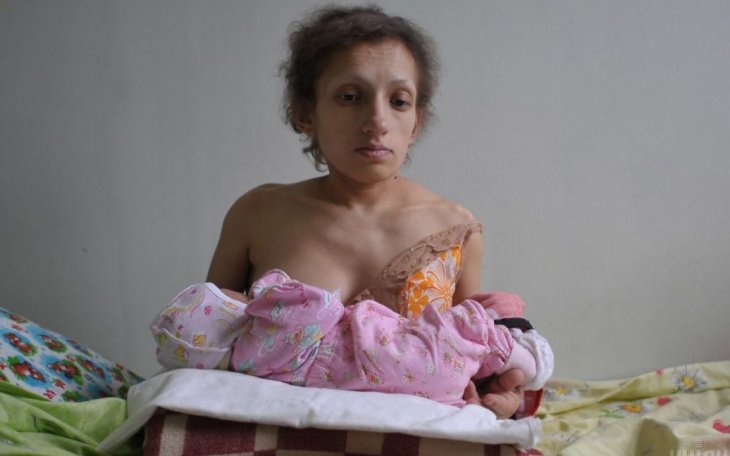 Померла найнижча в Україні мама: жінка мала зріст 96 см